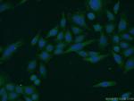 C1orf92 Antibody in Immunocytochemistry (ICC/IF)