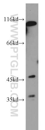 MFSD7 Antibody in Western Blot (WB)