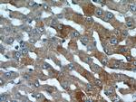 PML Antibody in Immunohistochemistry (Paraffin) (IHC (P))