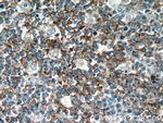 CD37 Antibody in Immunohistochemistry (Paraffin) (IHC (P))