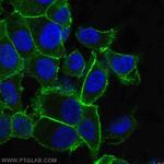 EPCAM Antibody in Immunocytochemistry (ICC/IF)