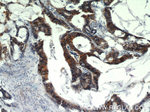 EPCAM Antibody in Immunohistochemistry (Paraffin) (IHC (P))