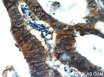 EPCAM Antibody in Immunohistochemistry (Paraffin) (IHC (P))