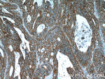 EPCAM Antibody in Immunohistochemistry (Paraffin) (IHC (P))