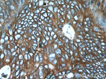 EPCAM Antibody in Immunohistochemistry (Paraffin) (IHC (P))