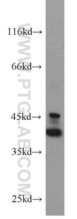 EPCAM Antibody in Western Blot (WB)