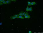 EPCAM Antibody in Immunocytochemistry (ICC/IF)