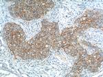 EPCAM Antibody in Immunohistochemistry (Paraffin) (IHC (P))