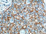 EPCAM Antibody in Immunohistochemistry (Paraffin) (IHC (P))