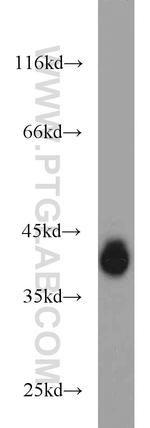 EPCAM Antibody in Western Blot (WB)