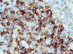 CD79B Antibody in Immunohistochemistry (Paraffin) (IHC (P))