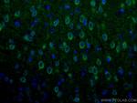 Synaptopodin Antibody in Immunohistochemistry (PFA fixed) (IHC (PFA))