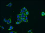 MLKL Antibody in Immunocytochemistry (ICC/IF)