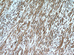 CNN2 Antibody in Immunohistochemistry (Paraffin) (IHC (P))