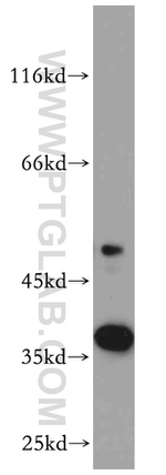 CNN2 Antibody in Western Blot (WB)