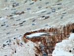 CNN2 Antibody in Immunohistochemistry (Paraffin) (IHC (P))