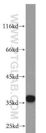 CNN2 Antibody in Western Blot (WB)