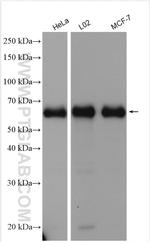 ACBD5 Antibody in Western Blot (WB)