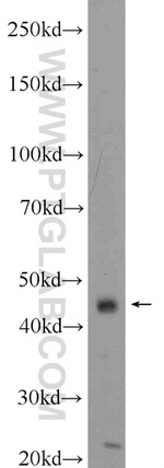 ACBD5 Antibody in Western Blot (WB)