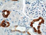 GPRC5D Antibody in Immunohistochemistry (Paraffin) (IHC (P))