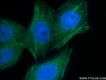 AFAP1 Antibody in Immunocytochemistry (ICC/IF)