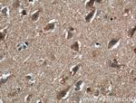 AFAP1 Antibody in Immunohistochemistry (Paraffin) (IHC (P))