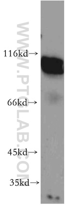 AFAP1 Antibody in Western Blot (WB)