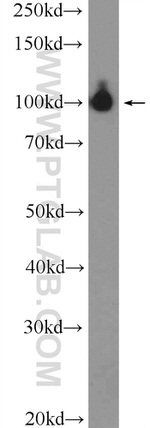 AFAP1 Antibody in Western Blot (WB)