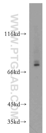 RANBP10 Antibody in Western Blot (WB)