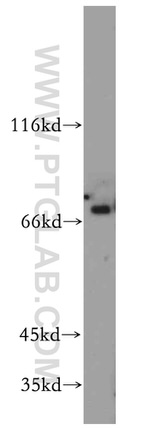 RANBP10 Antibody in Western Blot (WB)