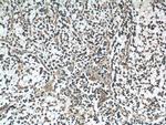 DKK1 Antibody in Immunohistochemistry (Paraffin) (IHC (P))