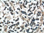 DKK1 Antibody in Immunohistochemistry (Paraffin) (IHC (P))