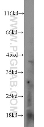 DKK1 Antibody in Western Blot (WB)