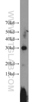 DKK1 Antibody in Western Blot (WB)