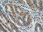 FAM101A Antibody in Immunohistochemistry (Paraffin) (IHC (P))