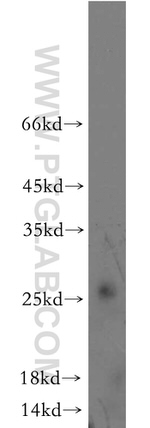 FAM101A Antibody in Western Blot (WB)