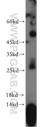 FAM101A Antibody in Western Blot (WB)