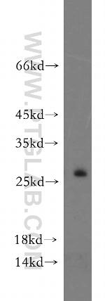 FAM101A Antibody in Western Blot (WB)