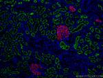 ACE2 Antibody in Immunohistochemistry (PFA fixed) (IHC (PFA))