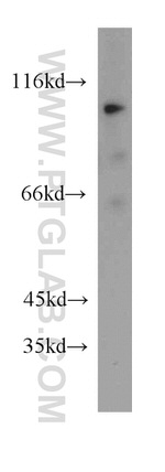 ACE2 Antibody in Western Blot (WB)