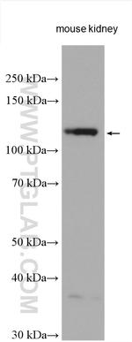 ACE2 Antibody in Western Blot (WB)