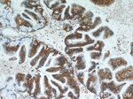 Claudin 18 Antibody in Immunohistochemistry (Paraffin) (IHC (P))