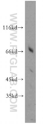 HPSE2 Antibody in Western Blot (WB)