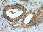 KIAA1199 Antibody in Immunohistochemistry (Paraffin) (IHC (P))