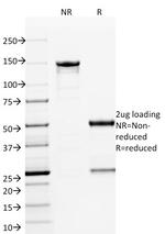 ETS1 (Marker of Tumor Metastasis) Antibody in SDS-PAGE (SDS-PAGE)