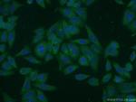 MAN2A1 Antibody in Immunocytochemistry (ICC/IF)