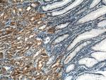 MAN2A1 Antibody in Immunohistochemistry (Paraffin) (IHC (P))