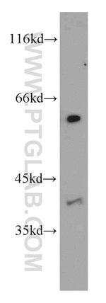 LIPC Antibody in Western Blot (WB)