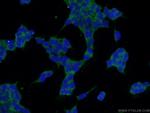 SPACA3 Antibody in Immunocytochemistry (ICC/IF)