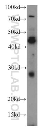 SPACA3 Antibody in Western Blot (WB)